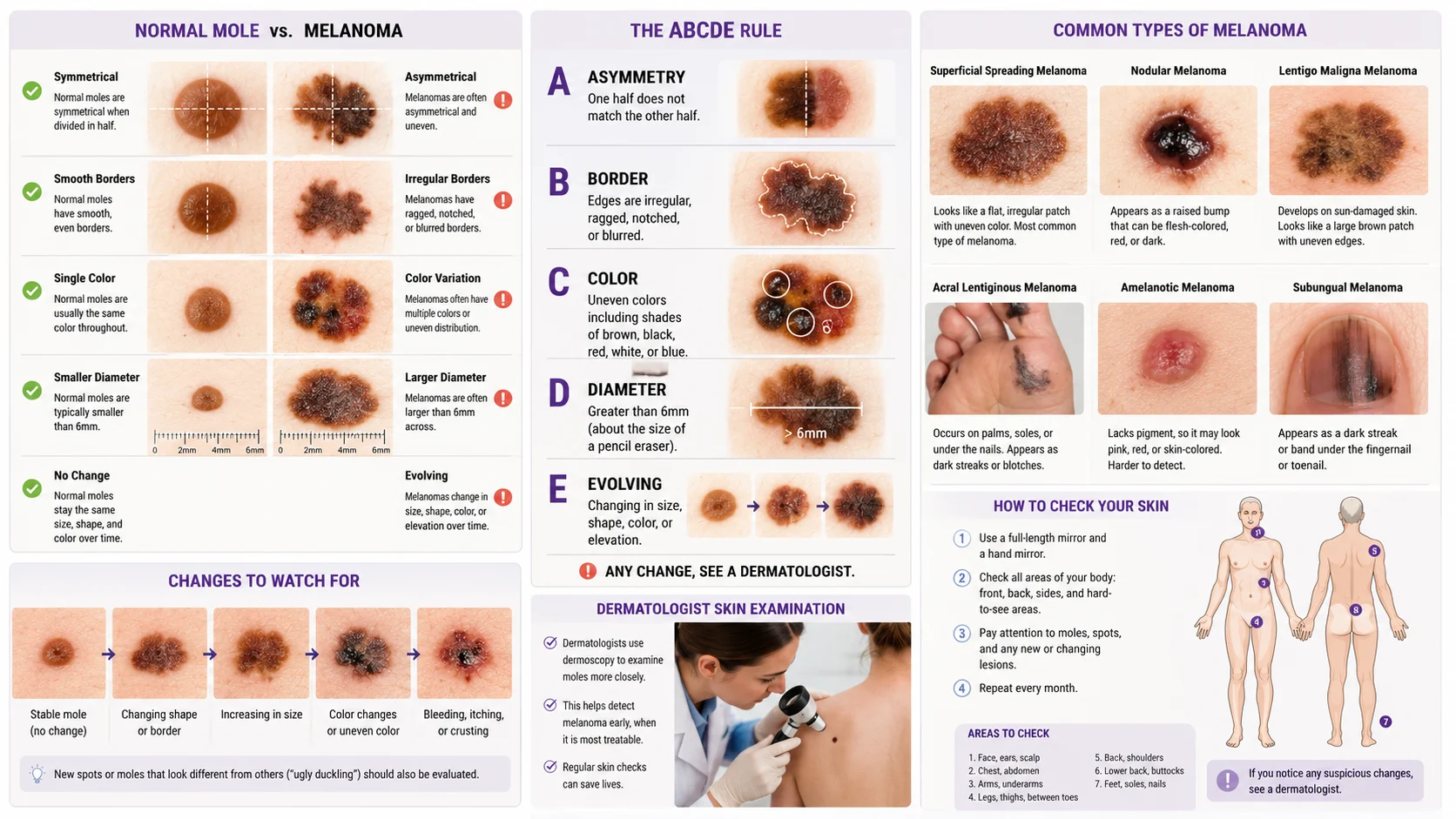 what does melanoma look like